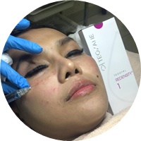 Injeksi Skin Booster